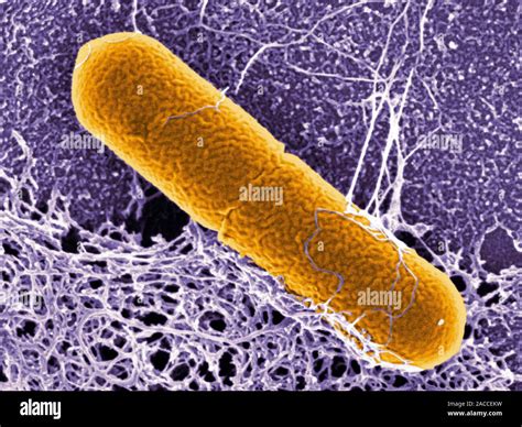 botulism bacteria shape